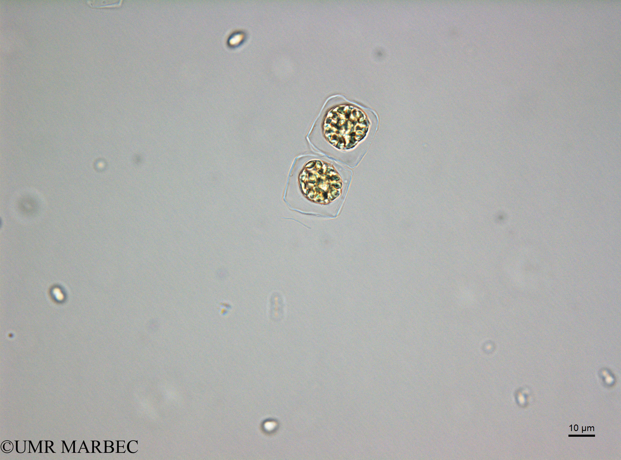 phyto/Scattered_Islands/juan_de_nova/COMMA2 November 2013/Cerataulina sp1 (D5_2_diatomee_ancien_melosira180717_001_ovl-10)(copy).jpg